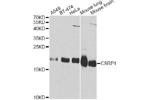 Western blot analysis of extracts of various cell lines, using CSRP1 Antibody (ABIN5970430) at 1/1000 dilution. (CSRP1 抗体)
