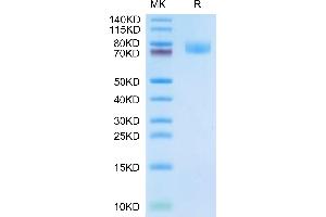 SDS-PAGE (SDS) image for Activated Leukocyte Cell Adhesion Molecule (ALCAM) (AA 28-527) protein (His tag) (ABIN7273814)