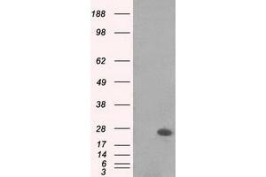 Image no. 1 for anti-MAD2 Mitotic Arrest Deficient-Like 1 (Yeast) (MAD2L1) antibody (ABIN1499249) (MAD2L1 抗体)