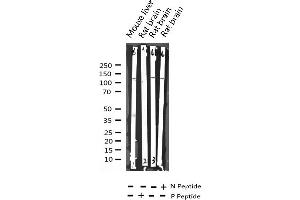 Western blot analysis of Phospho-HDAC4 (Ser632) expression in various lysates (HDAC4 抗体  (pSer632))