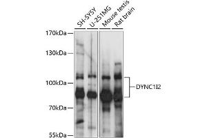 Western blot analysis of extracts of various cell lines, using DYNC1I2 antibody (ABIN7266862) at 1:1000 dilution. (DYNC1I2 抗体  (AA 352-612))