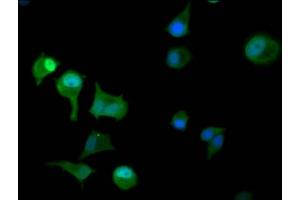Immunofluorescence staining of MCF-7 cells with ABIN7145552 at 1:100, counter-stained with DAPI.