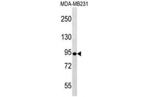 Western blot analysis of POU6F2 Antibody (N-term) in MDA-MB231 cell line lysates (35ug/lane).