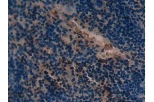 Detection of SOD2 in Mouse Spleen Tissue using Polyclonal Antibody to Superoxide Dismutase 2, Mitochondrial (SOD2) (SOD2 抗体  (AA 25-222))