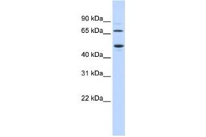 Western Blotting (WB) image for anti-Tryptophan 2,3-Dioxygenase (TDO2) antibody (ABIN2458954) (TDO2 抗体)