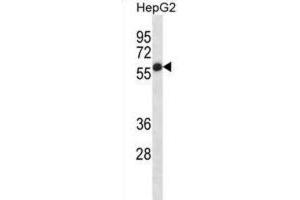 Western Blotting (WB) image for anti-Placental Alkaline Phosphatase (ALPP) antibody (ABIN2998362) (PLAP 抗体)