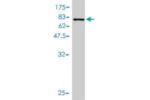 Western Blot detection against Immunogen (72. (Retinoblastoma Binding Protein 4 抗体  (AA 1-425))