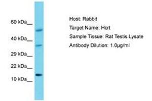 Image no. 1 for anti-Orexin (OX) (AA 45-94) antibody (ABIN6750422) (Orexin 抗体  (AA 45-94))