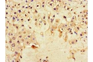 Immunohistochemistry of paraffin-embedded human placenta tissue using ABIN7150861 at dilution of 1:100 (DNAH1 抗体  (AA 2225-2407))