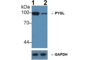 Western blot analysis of (1) Wild-type Hepg2 cell lysate, and (2) PYGL knockout Hepg2 cell lysate, using Rabbit Anti-Rat PYGL Ab (1 µg/ml) and HRP-conjugated Goat Anti-Mouse antibody (