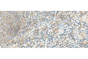 anti-Major Histocompatibility Complex, Class II, DR beta 4 (HLA-DRB4) antibody