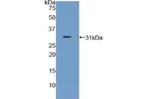 Western blot analysis of recombinant Mouse GHR. (Growth Hormone Receptor 抗体  (AA 36-266))