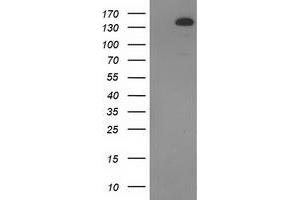 Western Blotting (WB) image for anti-TBC1 Domain Family, Member 4 (TBC1D4) antibody (ABIN1501319) (TBC1D4 抗体)