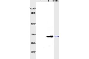Lane 1: mouse brain lysates Lane 2: mouse kidney lysates probed with Anti CDK4 Polyclonal Antibody, Unconjugated (ABIN671166) at 1:200 in 4 °C. (CDK4 抗体  (AA 241-303))