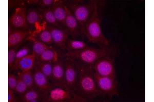 Immunofluorescence staining of methanol-fixed MCF cells using Progesterone Receptor(Phospho-Ser190) Antibody. (Progesterone Receptor 抗体  (pSer190))