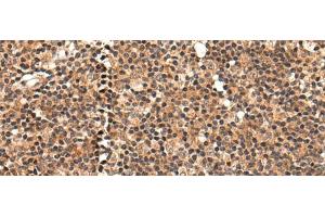Immunohistochemistry of paraffin-embedded Human tonsil tissue using C16orf45 Polyclonal Antibody at dilution of 1:45(x200) (C16orf45 抗体)