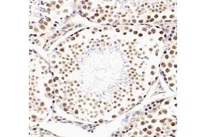 Immunohistochemistry of paraffin embedded mouse testis using RBM8A (ABIN7075478) at dilution of 1: 300 (300x lens)
