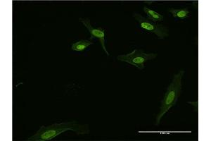 Immunofluorescence (IF) image for anti-Basic Leucine Zipper Transcriptional Factor ATF-Like 3 (BATF3) (AA 1-127) antibody (ABIN949453)