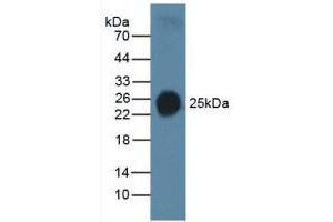 Western blot analysis of Human Serum. (Surfactant Protein C 抗体  (AA 24-197))