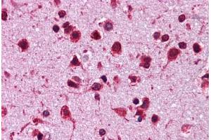 Immunohistochemistry (Formalin-fixed Paraffin-embedded Sections) (IHC (fp)) image for anti-Heat Shock Protein 90kDa alpha (Cytosolic), Class B Member 1 (HSP90AB1) (N-Term) antibody (ABIN574430)