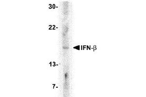 Western Blotting (WB) image for anti-Interferon, beta 1, Fibroblast (IFNB1) (Center) antibody (ABIN2474126) (IFNB1 抗体  (Center))
