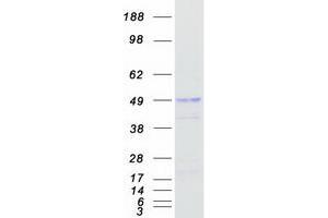 Western Blotting (WB) image for RUN Domain Containing 3A (RUNDC3A) (Transcript Variant 2) protein (Myc-DYKDDDDK Tag) (ABIN2731250)