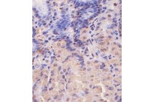 (ABIN650677 and ABIN2838644) staining EIF4E2 in human stomach tissue sections by Immunohistochemistry (IHC-P - paraformaldehyde-fixed, paraffin-embedded sections). (EIF4E2 抗体)
