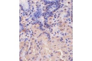 (ABIN650677 and ABIN2838644) staining EIF4E2 in human stomach tissue sections by Immunohistochemistry (IHC-P - paraformaldehyde-fixed, paraffin-embedded sections). (EIF4E2 抗体)