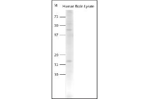 Western blot on human brain lysate using Rabbit antibody to pro BDNF (50-90): . (Pro BDNF 抗体)