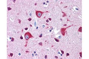 anti-Zinc Finger E-Box Binding Homeobox 2 (ZEB2) (C-Term) antibody