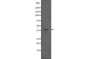 Western blot analysis of ADH6 using HUVEC whole cell lysates (ADH6 抗体)