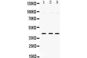 Western Blotting (WB) image for anti-Mitogen-Activated Protein Kinase 13 (MAPK13) (AA 332-365), (C-Term) antibody (ABIN3043610) (MAPK13 抗体  (C-Term))