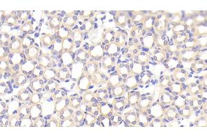Detection of SFXN1 in Mouse Kidney Tissue using Polyclonal Antibody to Sideroflexin 1 (SFXN1) (SFXN1 抗体  (AA 2-102))