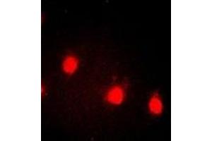 Immunofluorescent analysis of Cyclin E1 (pT77) staining in HEK293T cells. (Cyclin E1 抗体  (pSer77))