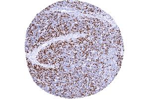 Strong TYMS staining of a large fraction of thymic lymphocytes (Recombinant TYMS 抗体  (Center))