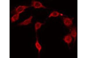 ABIN6267667 staining NIH-3T3 by IF/ICC. (CDC37 抗体  (pSer13))