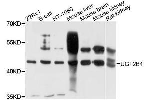 Western blot analysis of extracts of various cells, using UGT2B4 antibody. (UGT2B4 抗体)