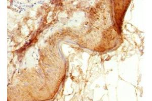 Immunohistochemistry of paraffin-embedded human skin tissue using ABIN7151902 at dilution of 1:100 (EPS15L1 抗体  (AA 585-864))