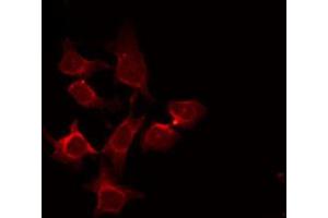 ABIN6272266 staining COS7 by IF/ICC. (CSNK1G1 抗体)