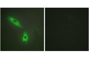 Immunofluorescence (IF) image for anti-Lymphotoxin beta (TNF Superfamily, Member 3) (LTB) (AA 181-230) antibody (ABIN2889554) (LTB 抗体  (AA 181-230))