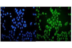 IF analysis of VCP using anti-VCP antibody (ABIN3043958).