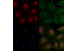 ABIN6263554 and ABIN6277124 staining  cells by IF/ICC.