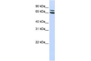 WB Suggested Anti-ZBTB48 Antibody Titration: 0. (ZBTB48 抗体  (Middle Region))