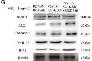 Decreased cAMP exaggerated acute gouty arthritis in P2Y14R-KO rats. (NLRP3 抗体  (AA 15-120))