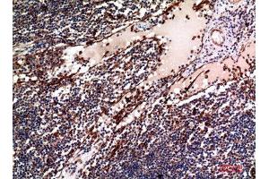 Immunohistochemistry (IHC) image for anti-Tumor Necrosis Factor (Ligand) Superfamily, Member 4 (TNFSF4) (Internal Region) antibody (ABIN6283257)