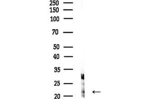 anti-NADH Dehydrogenase (Ubiquinone) 1 beta Subcomplex, 9, 22kDa (NDUFB9) (Internal Region) antibody