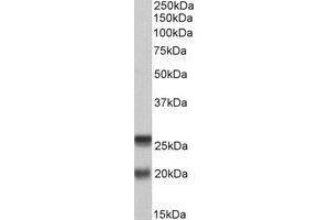 AP22412PU-N SNAP23 antibody staining of PBMC lysate at 0. (SNAP23 抗体  (C-Term))
