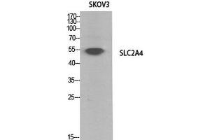 Western Blot analysis of SKOV3 cells using GLUT-4 Polyclonal Antibody at dilution of 1:1000. (GLUT4 抗体)