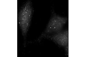 Immunofluorescence staining of Autophagy UVRAG antibody (ABIN388588 and ABIN2849986) on Methanol-fixed HeLa cells. (UVRAG 抗体  (AA 120-152))