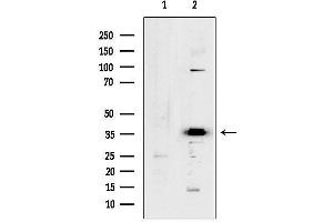 Western blot analysis of lysates from Mouse heart, using OR5 Antibody.
